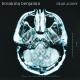 Breaking Benjamin - I Will Not Bow (Dear Agony)